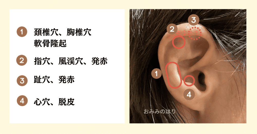 耳ツボ診断シェーグレン症候群