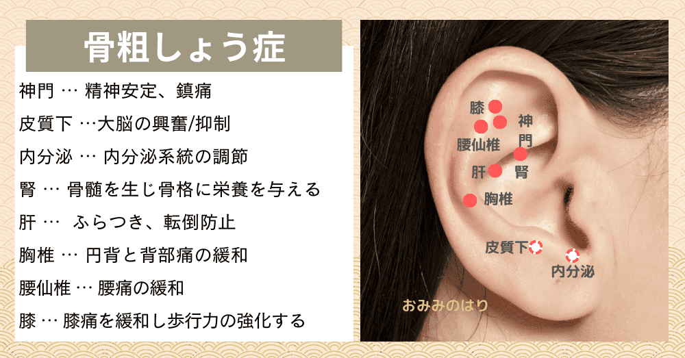 骨粗しょう症の耳ツボ耳ばり治療