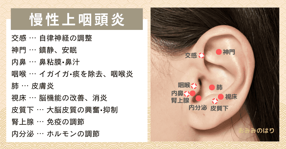 慢性上咽頭炎に対する耳ツボ耳鍼療法