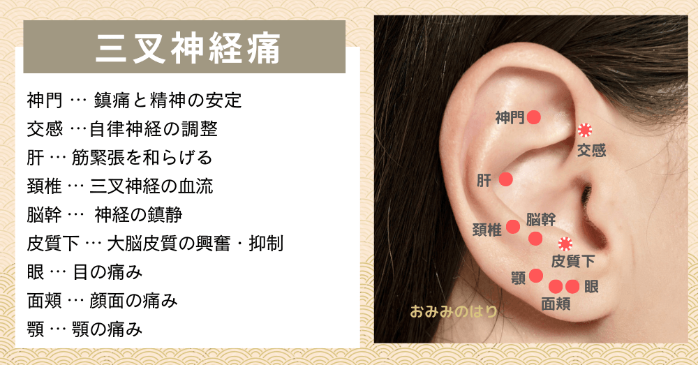 三叉神経痛を耳ツボ耳鍼治療で改善