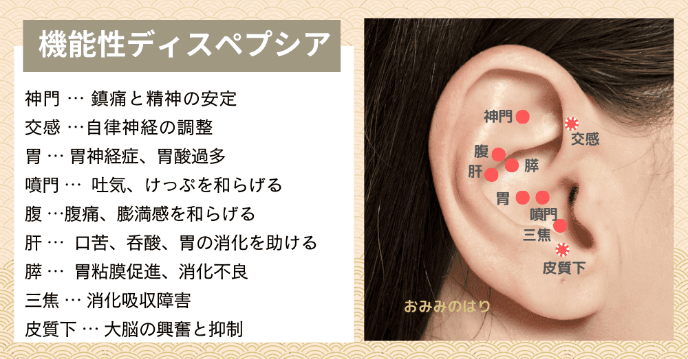 機能性ディスペプシア耳ツボ耳鍼治療で改善