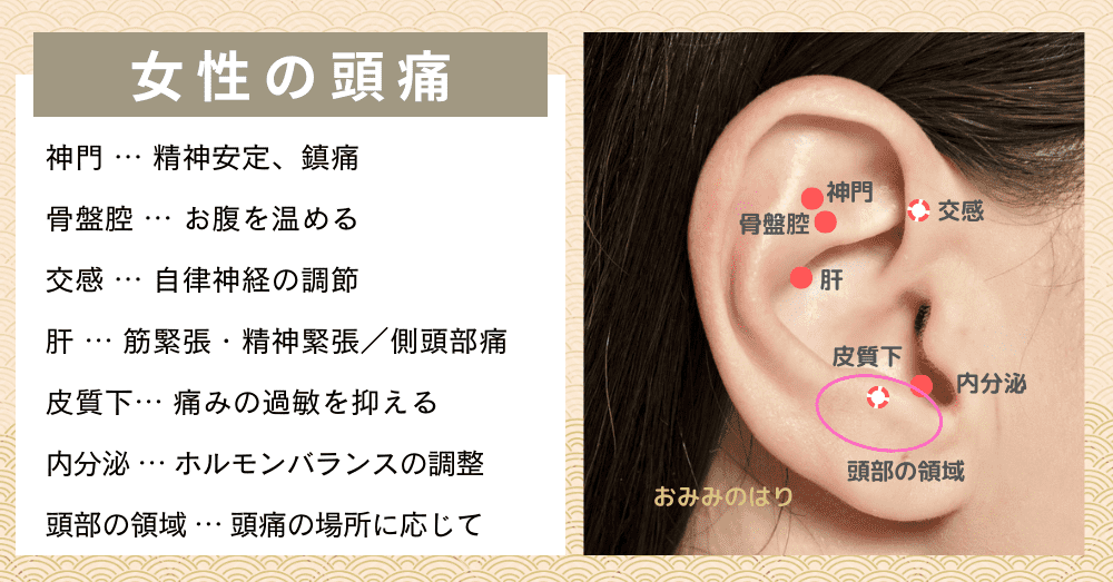 女性の頭痛を耳つぼ耳鍼治療で改善
