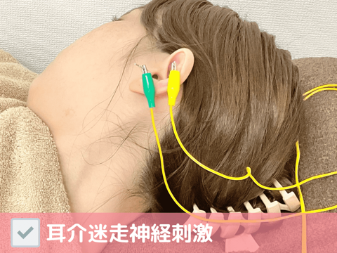 耳介迷走神経刺激
